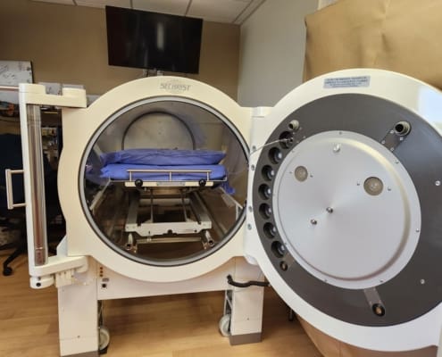 Hyperbaric Treatment Of Sensorineural Hearing Loss